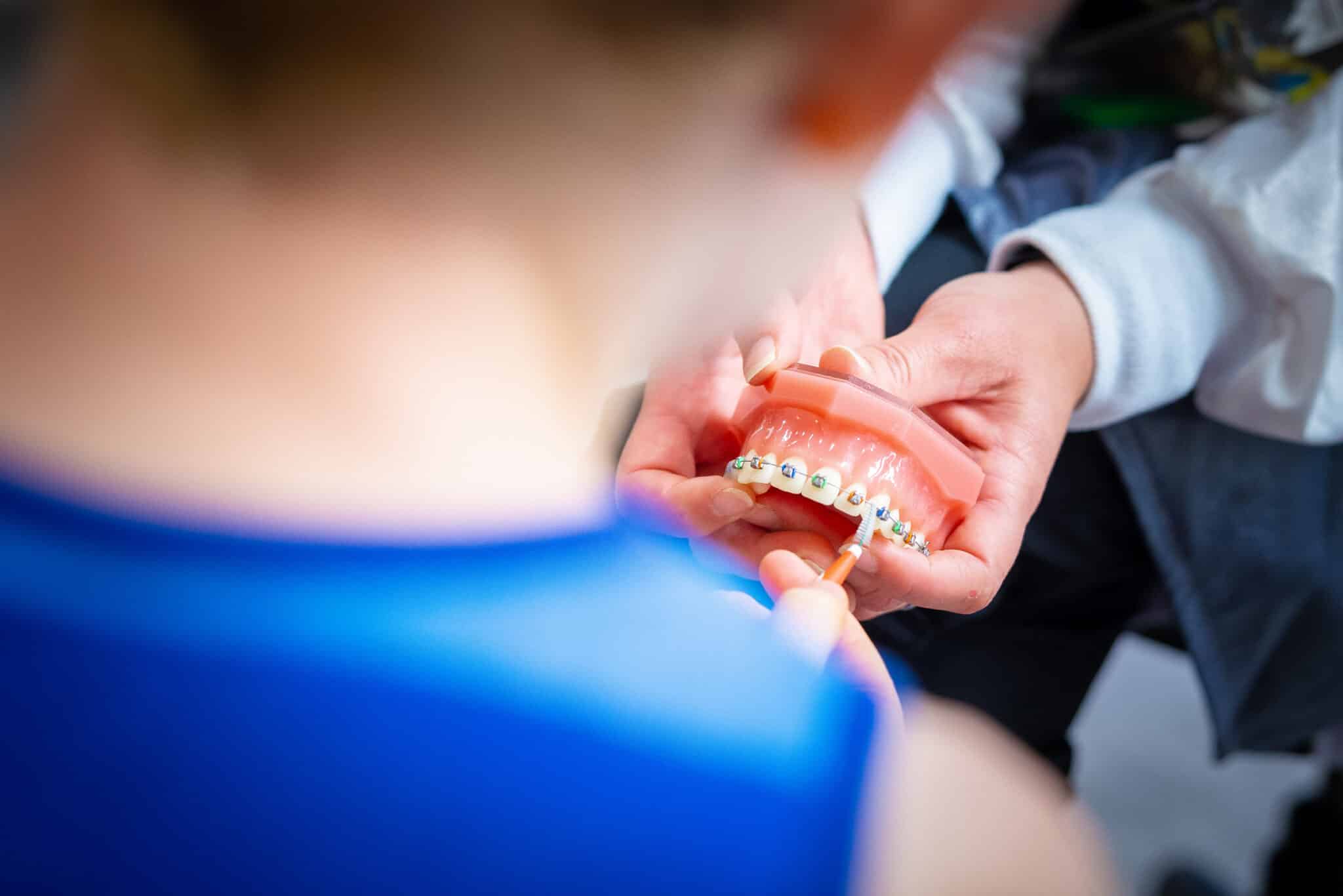 Adult Braces: Seven Reasons to Take the First Step