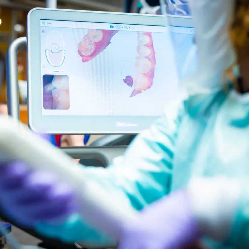 technology larson orthodontics alexandria va 2022 13