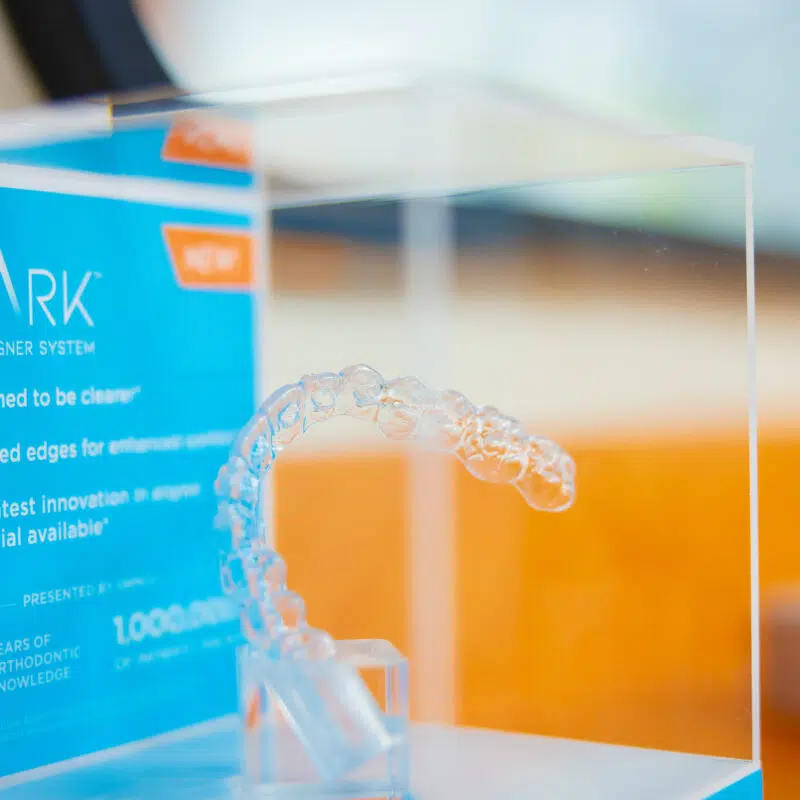technology larson orthodontics alexandria va 2022 18